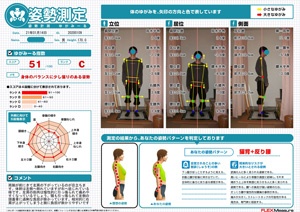 左肩が下がっているのが目立ちます
