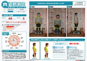 右臀部や股関節周りの筋肉が硬い