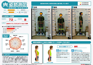 運動筋が余計な働きをしてしまっているようです。