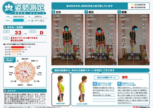身体の歪みが顕著に表れています