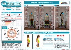 体幹が左側へ寄り左回旋が目立ちます