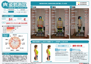 左側へ逃げた骨盤と反り腰