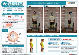 右足裏のアーチが潰れて腰痛に