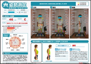 引っ張り合うことでの負担