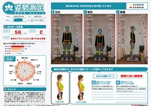 左側の腰椎を詰めたバランス補正