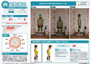 腰が反れて骨盤が左側へ寄っています