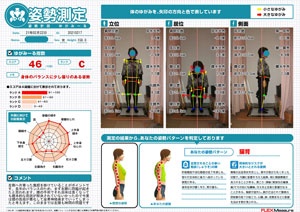 長年のバランスのためまず左膝に問題