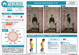 平背と反張膝が目立ちます