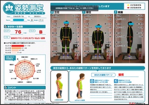 古傷の右手首の歪みが影響