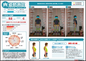 反り腰と顎自体の捻じれやスマホ首
