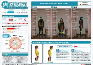 骨盤と頭が左へいき左脚に負担