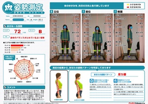 背骨が左右にズレている