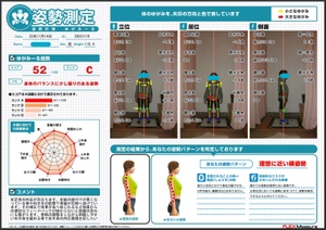 足首が内反し建付けが悪い