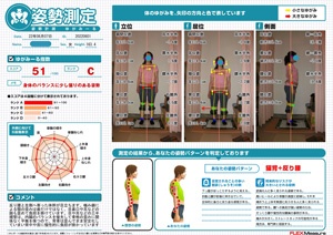 噛み癖による顎の歪み