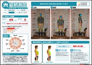 坐骨神経かもしれませんが…