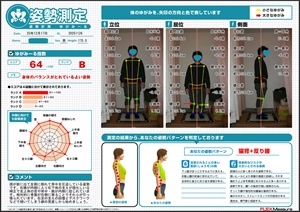 首や背中・腕が内側に捻じれて…