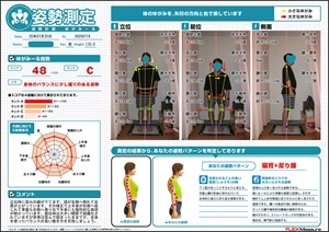 右側へ捻じれて骨盤も右側へ