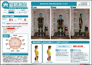 猫背や反り腰が目立ちますが…
