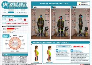 背骨が左へ倒れて捻じれています