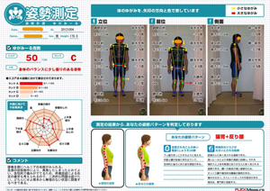 腰椎左側にヘルニアの兆候がみられる。