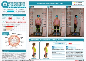 骨盤や肩など全身が左へ寄っています。