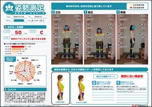 足裏アーチが潰れて腿前に過剰な負担