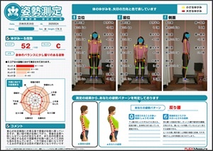 骨盤が左側へ捻じれている