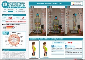 左膝が曲がり腰に慢性的に負担