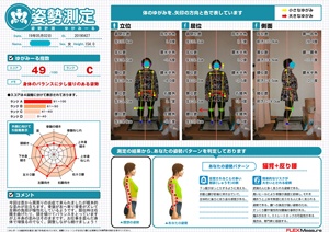 骨盤が左へ寄り背骨がズレて左側の負担