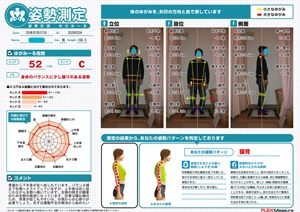 左側への傾きが顕著