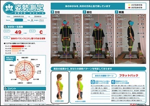 首の靭帯が緩く頭が右側へ