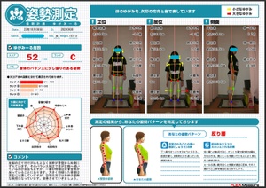 一番の特徴は背骨全体が反っている