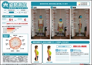股関節の収まりが悪い