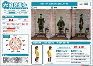 首や骨盤を逆側に捩じらせて補正