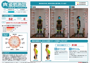 左肩が上がり上半身共に左へ寄っています。