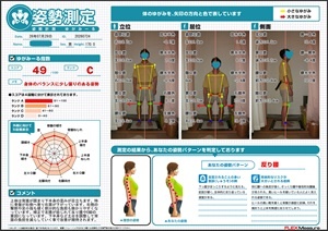 骨盤が右側へ寄り右肩が…