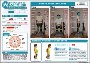 左足首の底屈不全