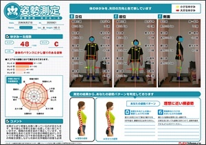左肩が上がり骨盤も左側へ