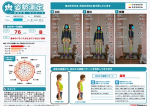 右骨盤の上がり目立ちます。