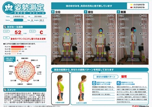 上半身の左側方変位が目立ちます