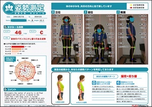 Your right knee joint is turned inward