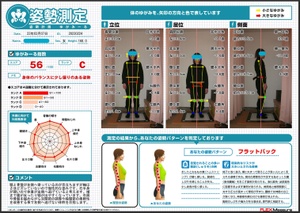 軸はさほどズレていないので