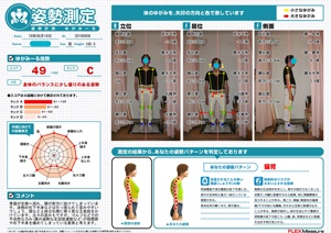 骨盤が左側へ流れ前方に抜けています。