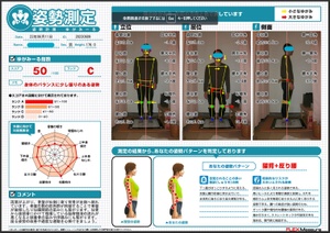 骨盤右側の筋肉群の拘縮