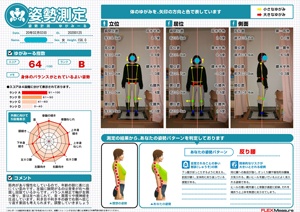 背骨が右へ側屈し回旋ている