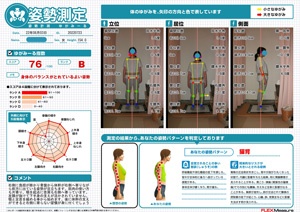 骨盤が前方に出ている姿勢が目立つ