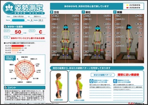 左膝が内側に入り骨盤が左側へ