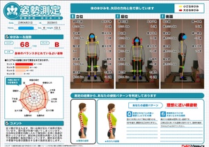 右側の体幹が潰れている